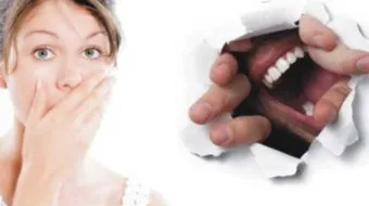 إزالة رائحة الفم الكريهة نهائياً