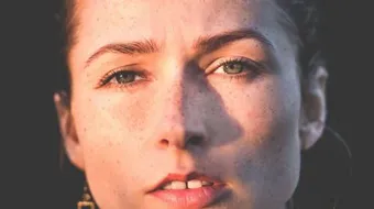 النمش والكلف