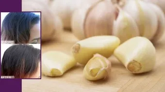 طريقة الثوم للشعر