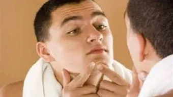 التخلص من حب الشباب