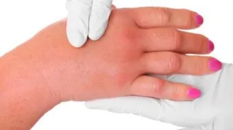 التخلص من الأملاح الزائدة في الجسم