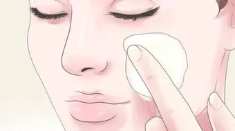 التخلص من حفر الوجه