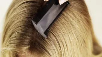 التخلص من قمل الشعر