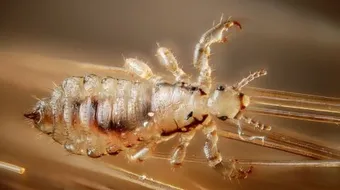 التخلص من القمل بالخل