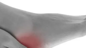 التخلص من الأملاح في الجسم