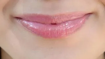 التخلص من سواد الشفاه