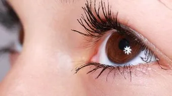 التخلص من تجاعيد حول العين