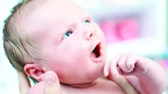 السيلان في حديثي الولادة