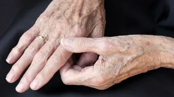 علاج النقرس