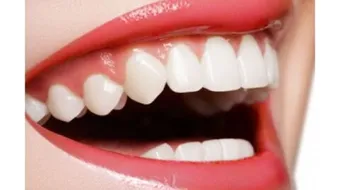 طرق علاج اللثة