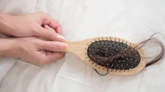 تساقط الشعر بغزارة