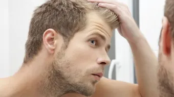 أضرار زراعة الشعر