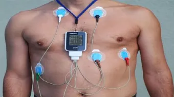 جهاز قياس دقات القلب