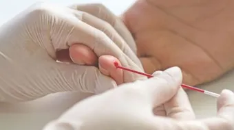 نقص الهيماتوكريت