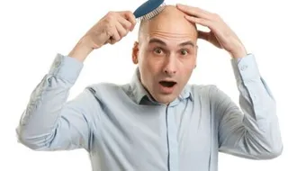 تساقط الشعر الوراثي