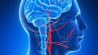 ارتفاع ضغط المخ