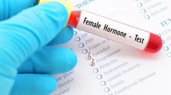 ارتفاع هرمون الحليب عند النساء