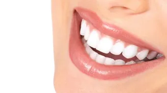 أضرار ابتسامة هوليود