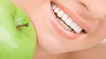 طرق تبييض الأسنان بالبيت