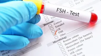 تحليل الهرمونات fsh