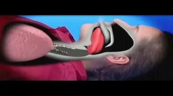 كيف يبلع الشخص لسانه