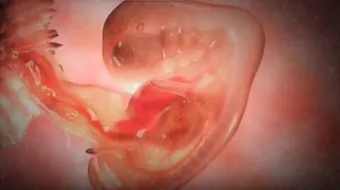 كم يكون حجم كيس الحمل في الأسبوع الخامس