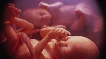 كيف أستطيع أن أعرف نوع الجنين