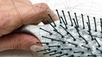 كيف يمكنني منع تساقط شعري