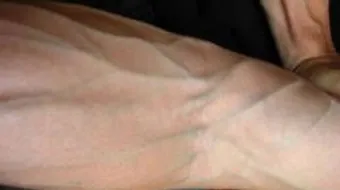 كيف تظهر عروق اليد