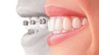 كيف أنظف أسناني