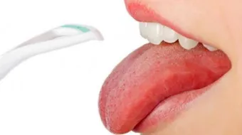 كيف أنظف لساني من البكتيريا