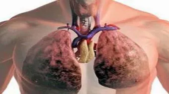 كيف أنظف الرئتين من اثار التدخين