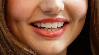 كيف أحصل على غمازات