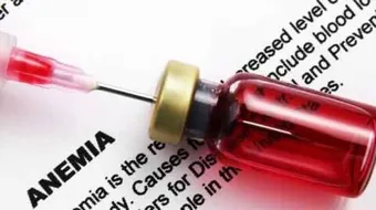 كيف أتخلص من فقر الدم بسرعة