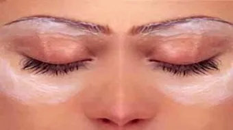 كيف أتخلص من البقع السوداء تحت العين