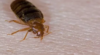 كيف أتخلص من البق