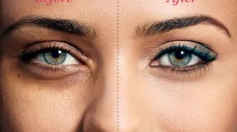 كيف أتخلص من الهالات السوداء نهائيا