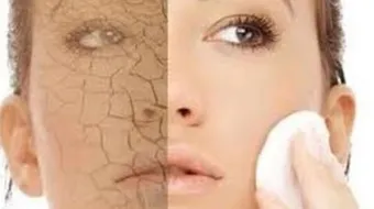 كيف أتخلص من جفاف البشره