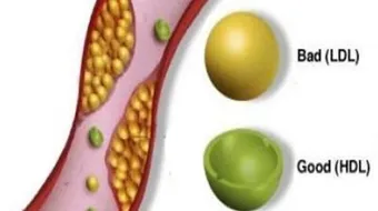 كيف أتخلص من الدهون في الدم