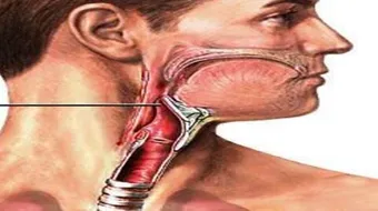 كيف أتخلص من عظم السمك في البلعوم