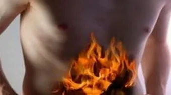 كيف أتخلص من حرقة المعدة