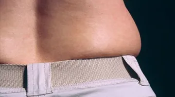 كيف أتخلص من دهون الخصر