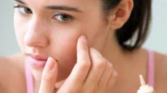 كيف أخفي حبوب الشباب