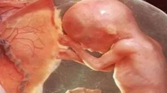 كيف أعرف إذا جنيني بخير في الشهر الرابع