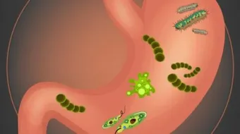 كيف أعرف الإصابة بجرثومة المعدة