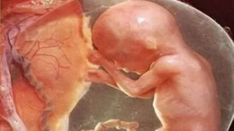 كيف أعرف نوع الجنين في الشهر الرابع