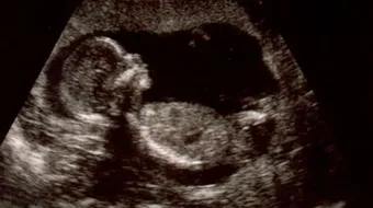 كيف أعرف وزن الجنين