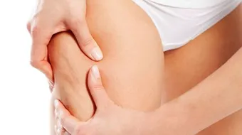 كيف أزيل السيلوليت من جسمي