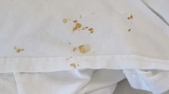 كيف ازيل بقع الصدأ من الملابس