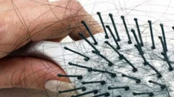 كيف أوقف تساقط شعري